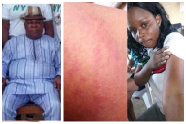 School Principal Brutally Flogs Female Corps Member In Akwa Ibom